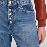 FRAME - The Loose Exposed Buttons