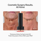 LYMA Laser PRO