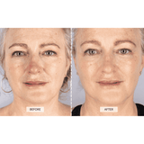 RETURNS - CurrentBody Skin Face & Neck Kit