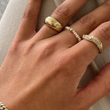 Kinn - Biwa Pearl Ring
