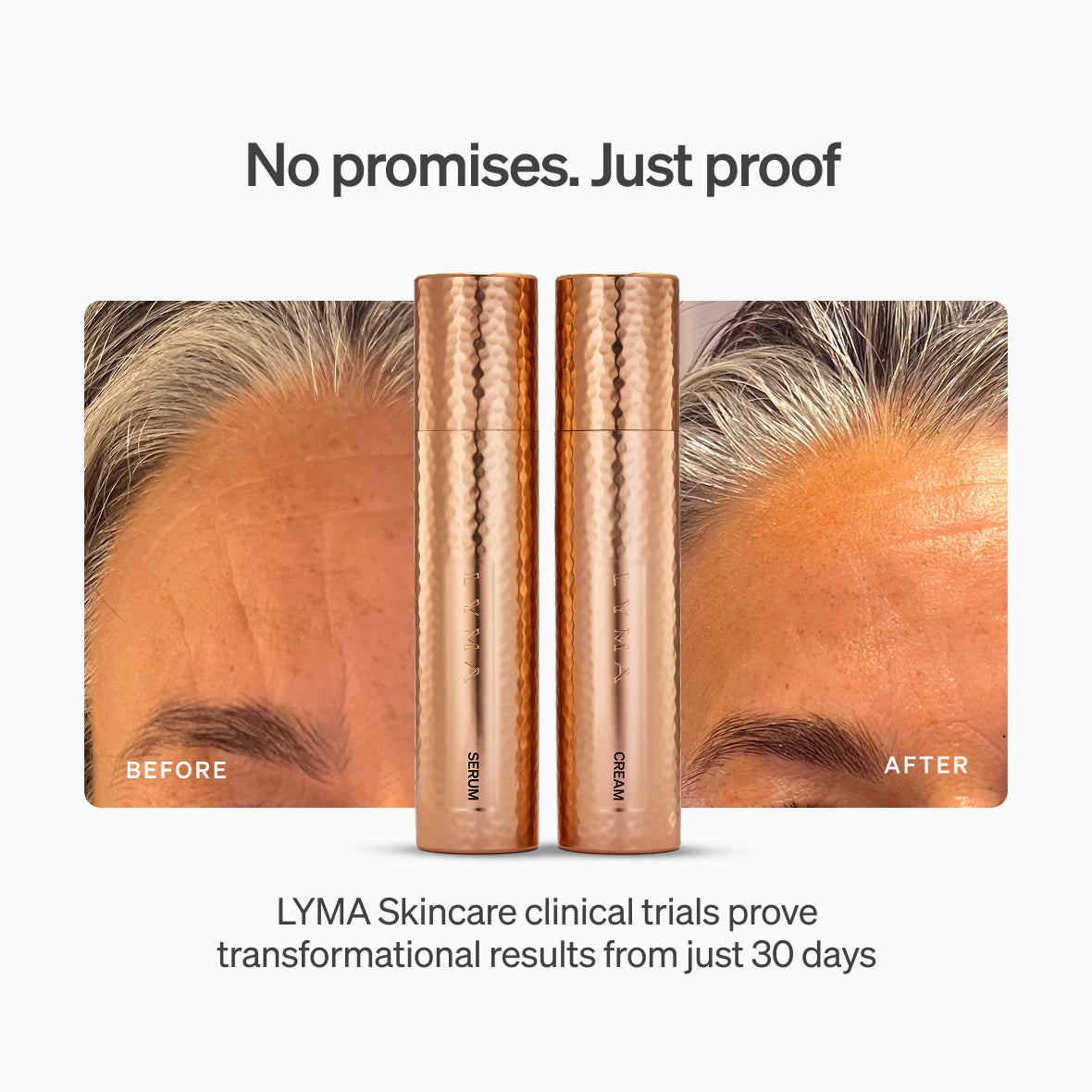 Lyma - LYMA Skincare