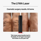 The LYMA Laser