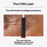 The LYMA Laser
