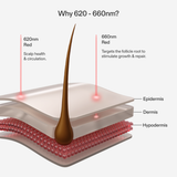 CurrentBody Skin LED Hair Growth Helmet